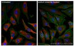 G3BP1 Antibody in Immunocytochemistry (ICC/IF)