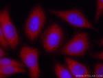 Spartin, SPG20 Antibody in Immunocytochemistry (ICC/IF)