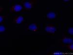 IFT88 Antibody in Immunocytochemistry (ICC/IF)