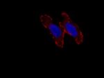 Liprin Alpha 1 Antibody in Immunocytochemistry (ICC/IF)