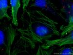 CEP250/CNAP1 Antibody in Immunocytochemistry (ICC/IF)