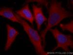 NBR1 Antibody in Immunocytochemistry (ICC/IF)