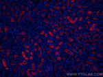 ACE2 Antibody in Immunohistochemistry (Paraffin) (IHC (P))