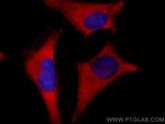 ROCK1 Antibody in Immunocytochemistry (ICC/IF)