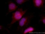 NFATC2 Antibody in Immunocytochemistry (ICC/IF)