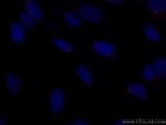 CEP164 Antibody in Immunocytochemistry (ICC/IF)