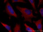 USP9X Antibody in Immunocytochemistry (ICC/IF)