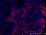 TGFBI/BIGH3 Antibody in Immunohistochemistry (Paraffin) (IHC (P))