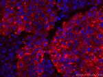 LGALS3BP Antibody in Immunohistochemistry (Paraffin) (IHC (P))