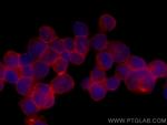 IFITM1 Antibody in Immunocytochemistry (ICC/IF)