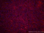 TNFR1 Antibody in Immunohistochemistry (Paraffin) (IHC (P))