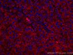 TNFR1 Antibody in Immunohistochemistry (Paraffin) (IHC (P))