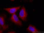 Galectin-1 Antibody in Immunocytochemistry (ICC/IF)