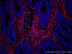 Galectin-1 Antibody in Immunohistochemistry (Paraffin) (IHC (P))