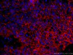 CD9 Antibody in Immunohistochemistry (Paraffin) (IHC (P))