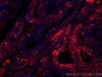 Thyroglobulin Antibody in Immunohistochemistry (Paraffin) (IHC (P))