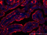 Thyroglobulin Antibody in Immunohistochemistry (Paraffin) (IHC (P))