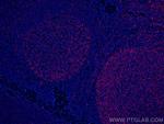 IL-19 Antibody in Immunohistochemistry (Paraffin) (IHC (P))