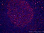 IL-36 Beta/IL-1F8 Antibody in Immunohistochemistry (Paraffin) (IHC (P))