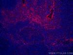 IL-2 Antibody in Immunohistochemistry (Paraffin) (IHC (P))