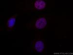 MUM1 Antibody in Immunocytochemistry (ICC/IF)