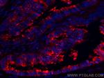 Protein C inhibitor Antibody in Immunohistochemistry (Paraffin) (IHC (P))