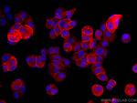 Annexin A2 Antibody in Immunocytochemistry (ICC/IF)