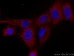 CSK Antibody in Immunocytochemistry (ICC/IF)