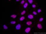 TBP Antibody in Immunocytochemistry (ICC/IF)