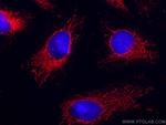 VAPB Antibody in Immunocytochemistry (ICC/IF)