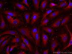 APOD Antibody in Immunocytochemistry (ICC/IF)