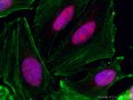 CHD4 Antibody in Immunocytochemistry (ICC/IF)