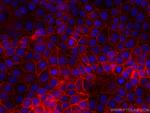 GNAS Antibody in Immunocytochemistry (ICC/IF)