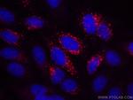 Alpha 1B-Glycoprotein Antibody in Immunocytochemistry (ICC/IF)