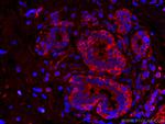 L2HGDH Antibody in Immunohistochemistry (Paraffin) (IHC (P))