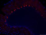 Calbindin-D28k Antibody in Immunohistochemistry (Paraffin) (IHC (P))