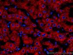 Plasminogen Antibody in Immunohistochemistry (Paraffin) (IHC (P))