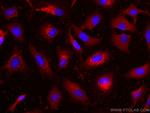 LDHB Antibody in Immunocytochemistry (ICC/IF)