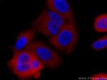 GDI1 Antibody in Immunocytochemistry (ICC/IF)