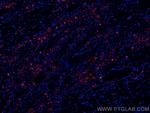 PSAP Antibody in Immunohistochemistry (Paraffin) (IHC (P))