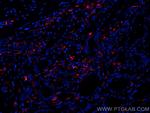 PSAP Antibody in Immunohistochemistry (Paraffin) (IHC (P))