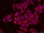 ATF6 Antibody in Immunocytochemistry (ICC/IF)