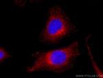 WBP2 Antibody in Immunocytochemistry (ICC/IF)