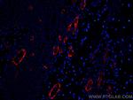 vwf Antibody in Immunohistochemistry (Paraffin) (IHC (P))