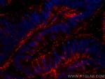 Galectin-4 Antibody in Immunohistochemistry (Paraffin) (IHC (P))