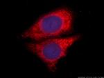 NEUROD1 Antibody in Immunocytochemistry (ICC/IF)