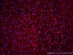 PSMB8 Antibody in Immunohistochemistry (Paraffin) (IHC (P))