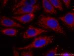 LACTB Antibody in Immunocytochemistry (ICC/IF)