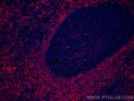 CCR6 Antibody in Immunohistochemistry (Paraffin) (IHC (P))