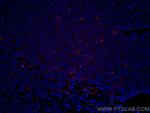 VE-cadherin Antibody in Immunohistochemistry (Paraffin) (IHC (P))